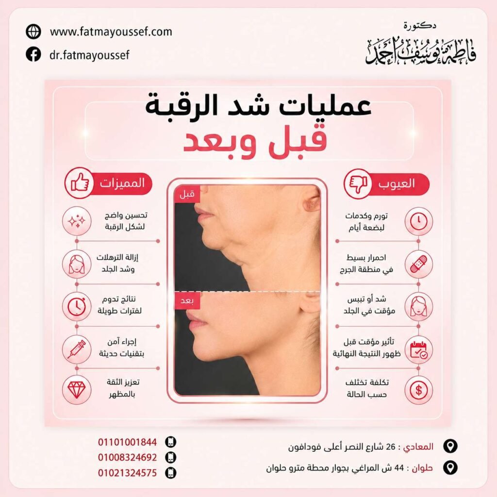 عمليات شد الرقبة قبل وبعد