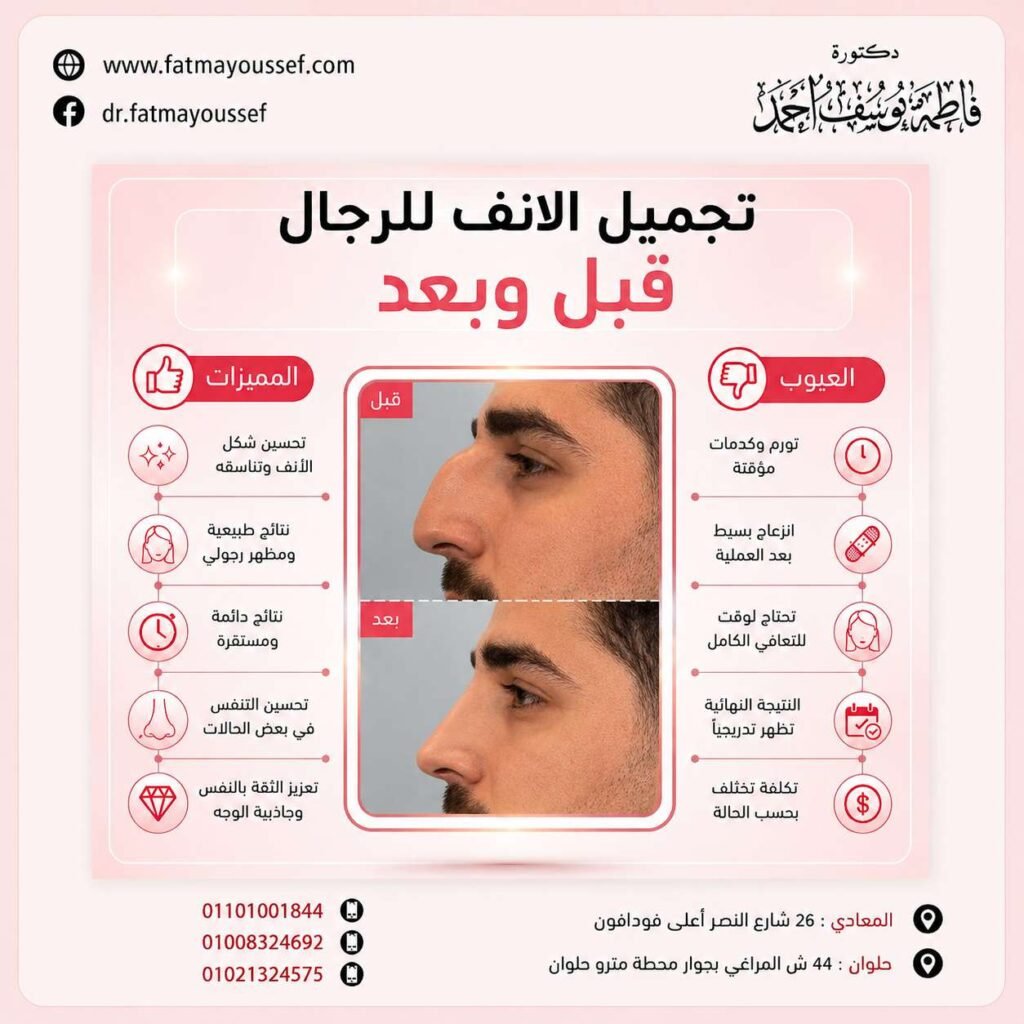 تجميل الانف للرجال قبل وبعد