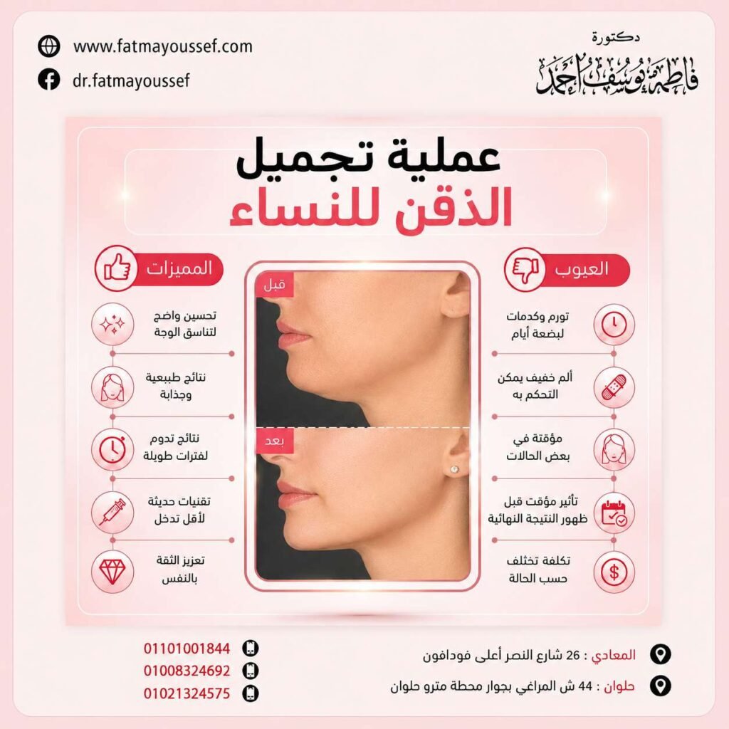 عملية تجميل الذقن للنساء