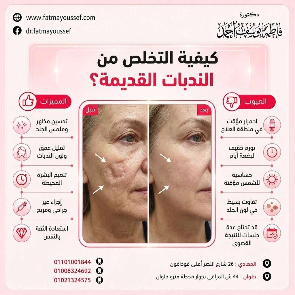 كيفية التخلص من الندبات القديمة