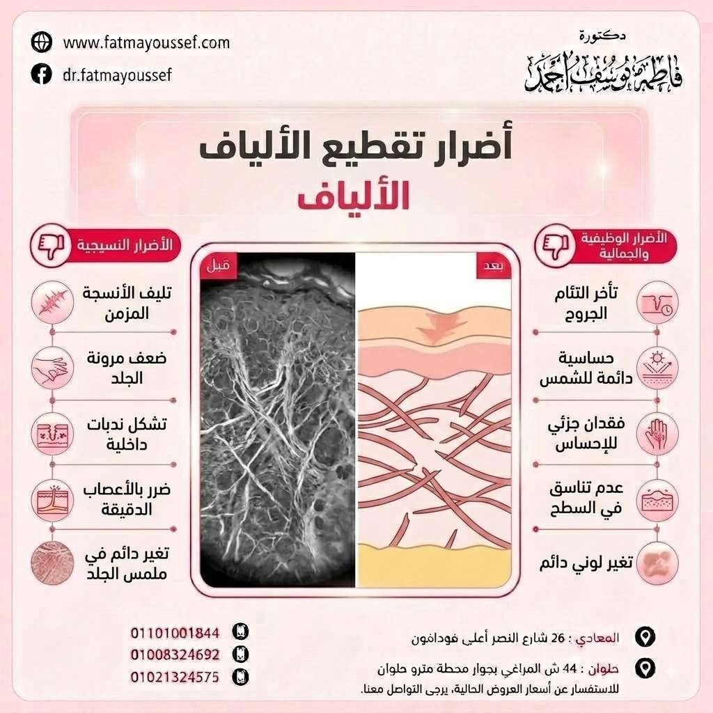 أضرار تقطيع الألياف