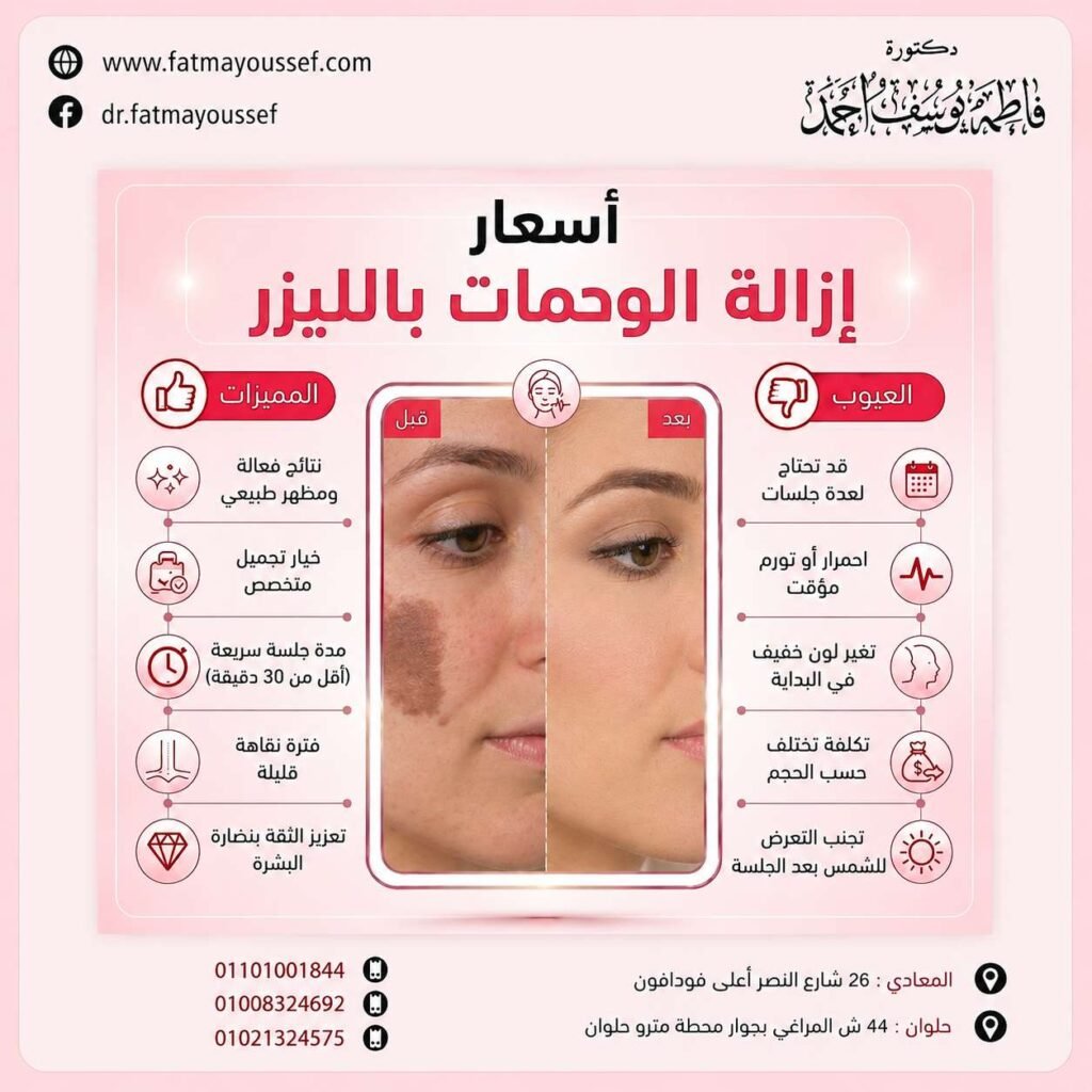 أسعار إزالة الوحمات بالليز
