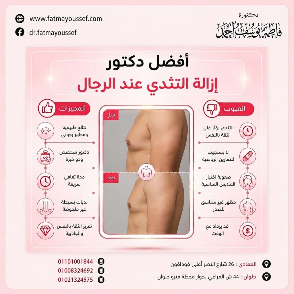 أفضل دكتور إزالة التثدي عند الرجال