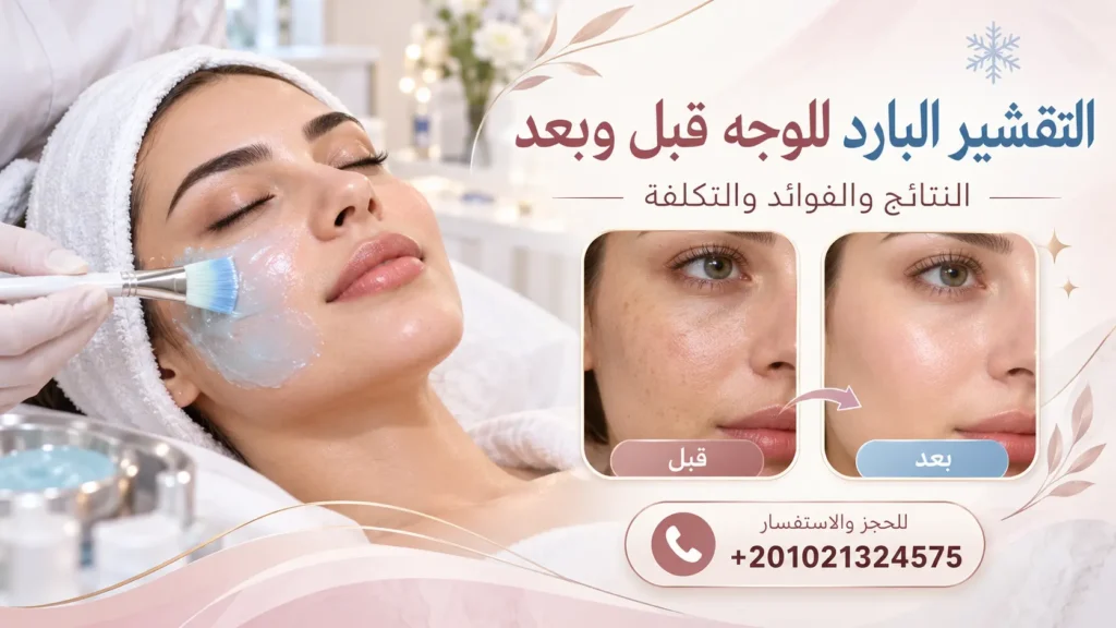 التقشير البارد للوجه قبل وبعد النتائج والفوائد والتكلفة