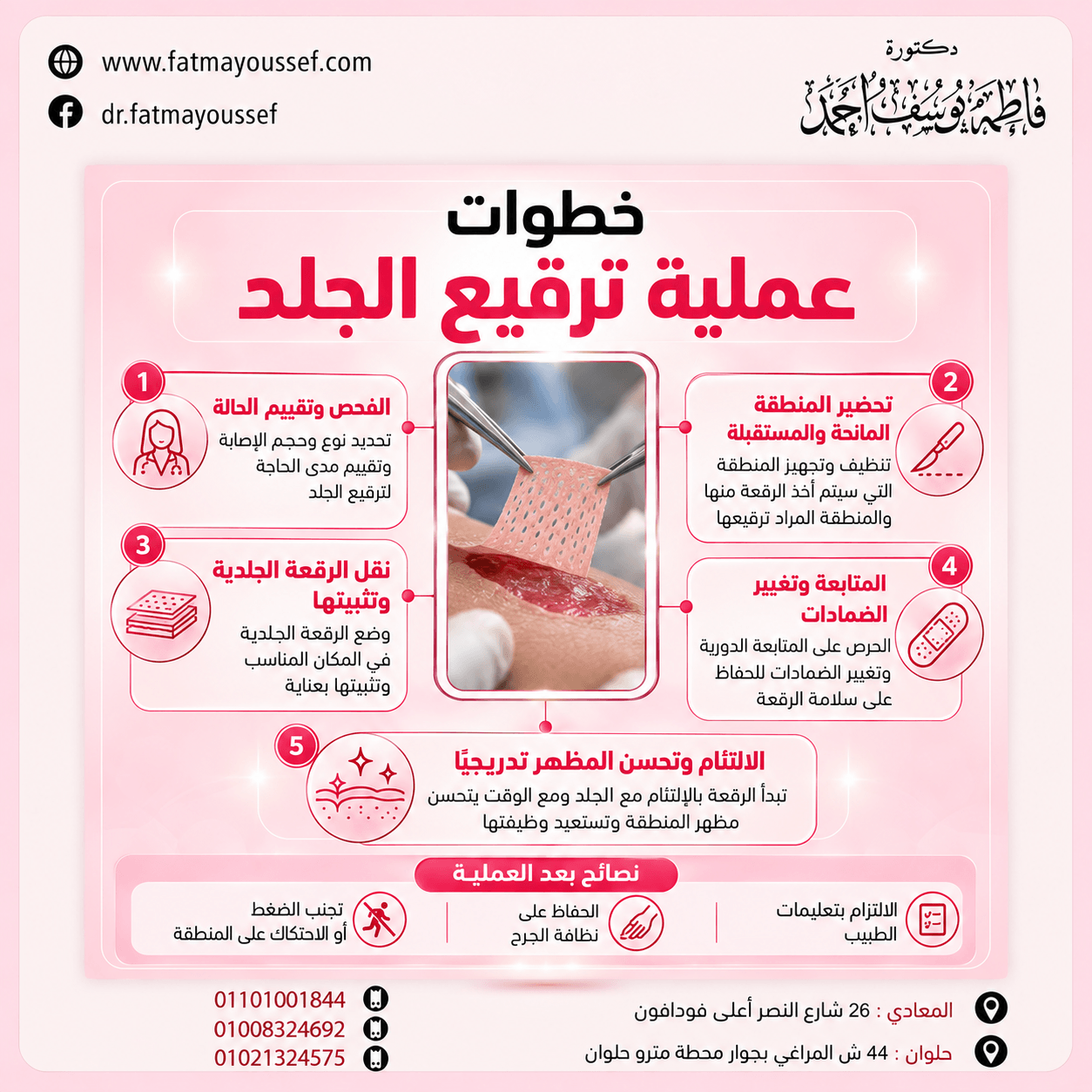 رسم طبي توضيحي لطريقة تغطية منطقة جلدية متضررة برقعة من جلد سليم