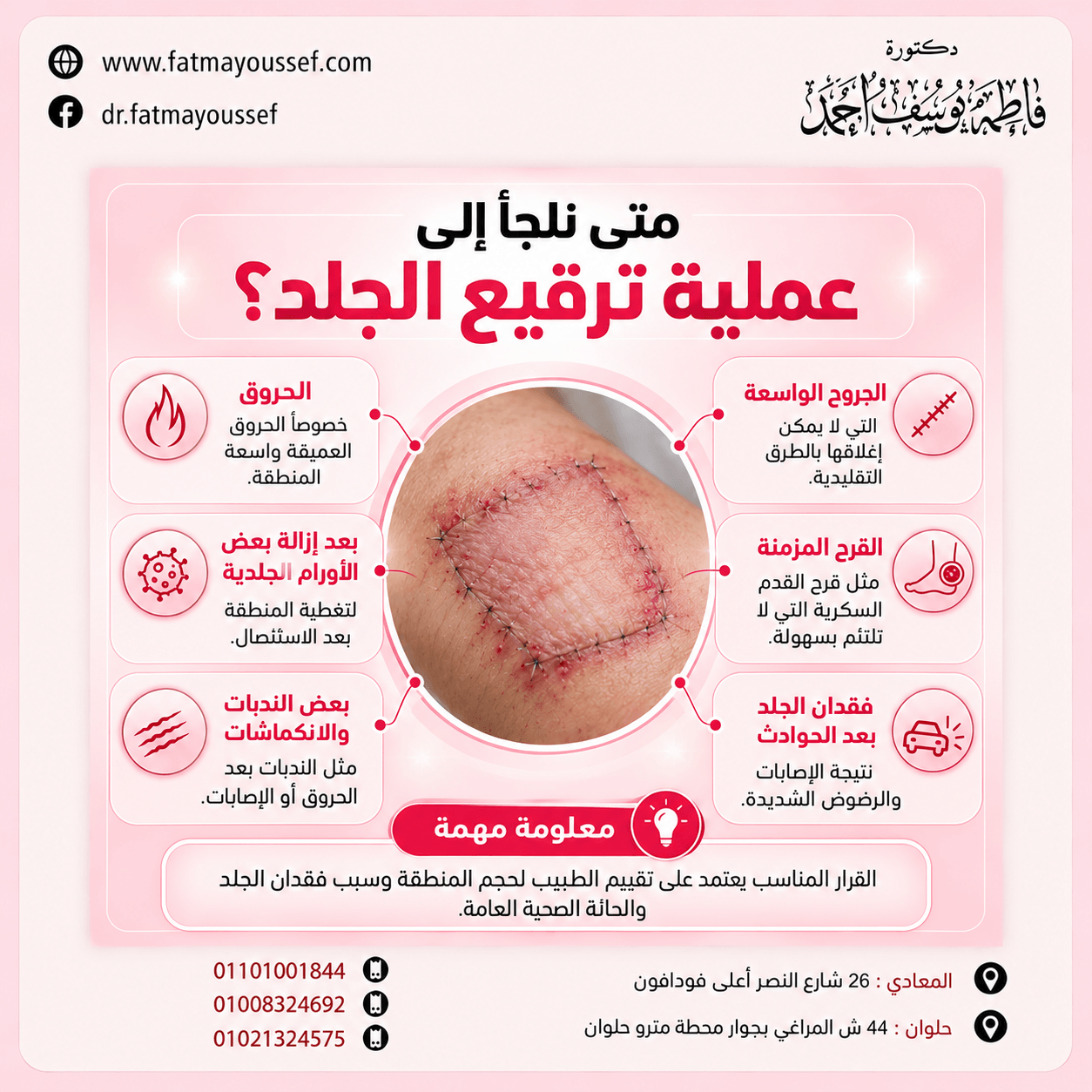 صورة توضيحية تتعلق بترقيع الجلد والتعافي بعد تغطية منطقة جلدية متضررة